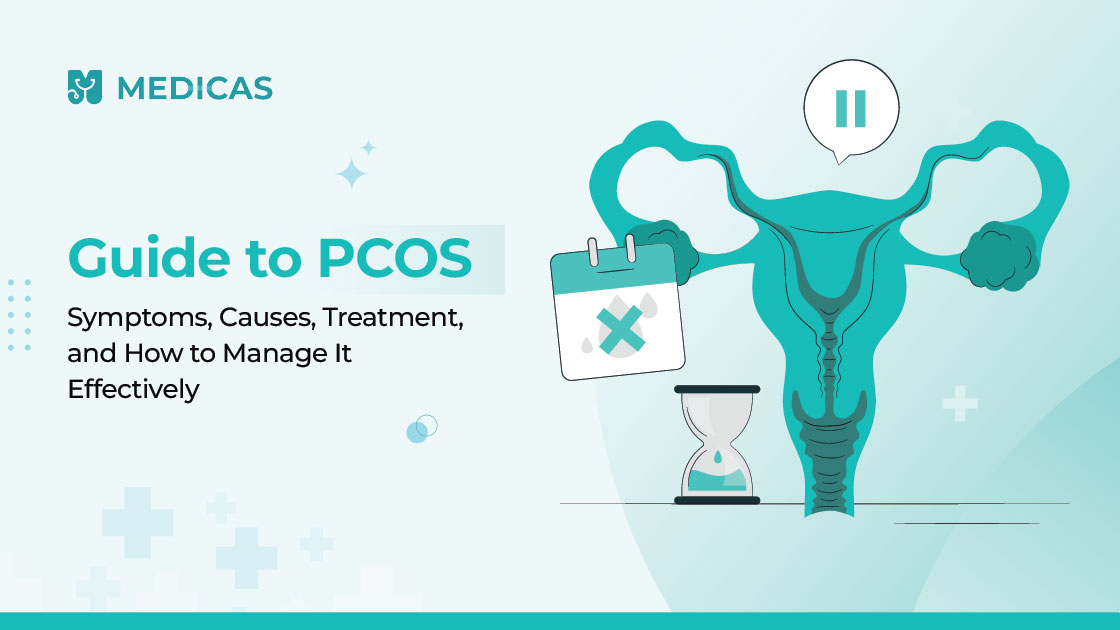 PCOS Guide