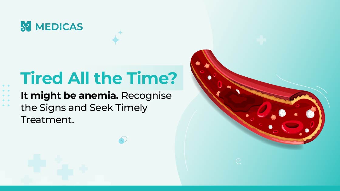 anemia