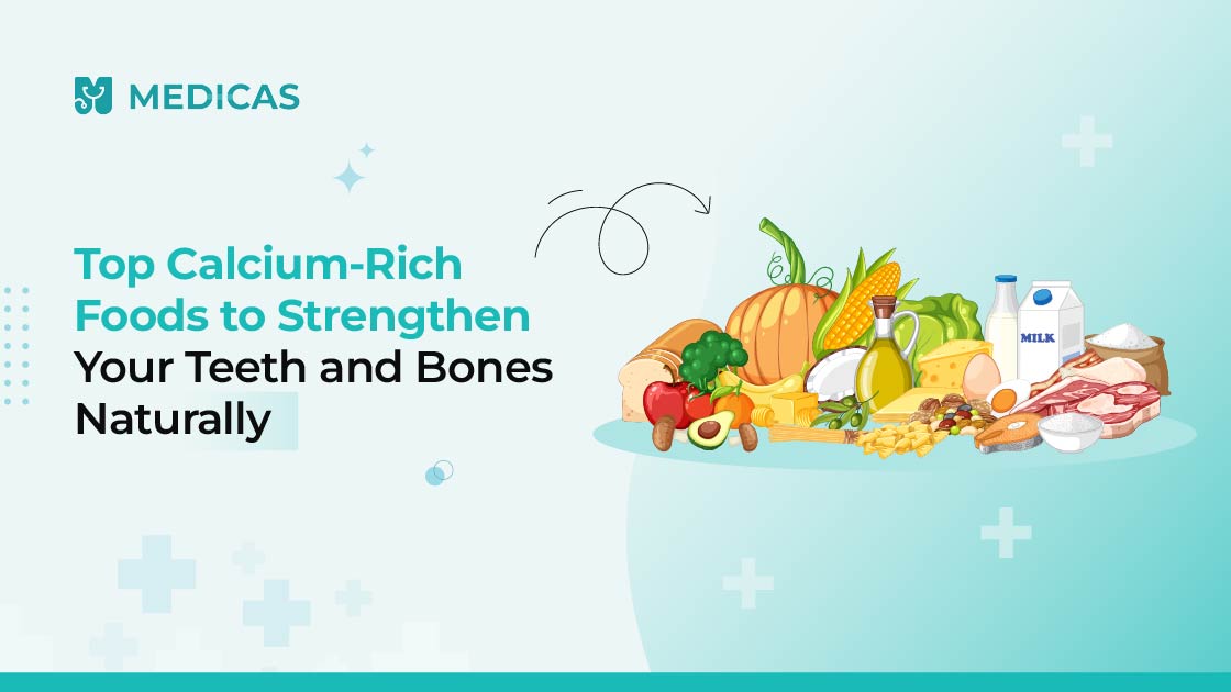 calcium rich food